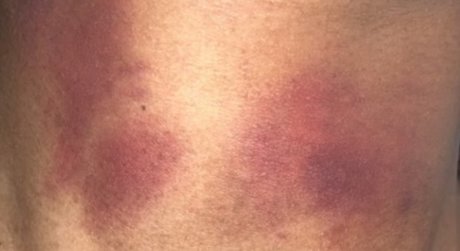 Dolly Girl naked leaks OnlyFans pic