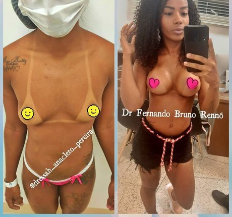 Nagie wyciekłe zdjęcie OnlyFans od Dressahanacletopereira